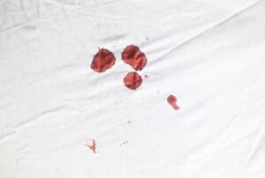 Tricks to remove blood stains from white clothes